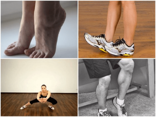 varicose veins cause pain in the legs