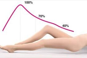 pressure distribution of compression stockings for varicose veins