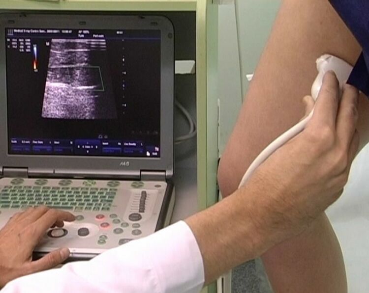 ultrasound diagnosis of varicose veins of the pelvis