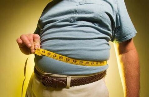 being overweight causes the development of varicose veins
