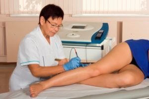 how to get rid treatment of varicose veins