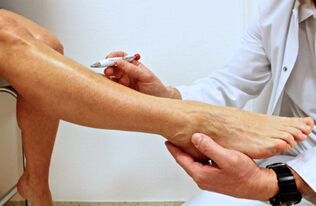 A patient with varicose veins is examined by a phlebologist